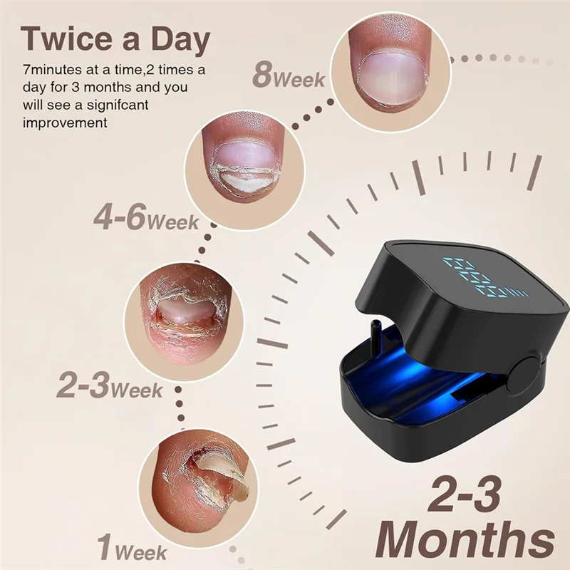For Home Use Nail Fungus Treatment Device 905Nm Infrared And 470Nm Blue LED Laser Efficient Onychomycosis Therapy Black