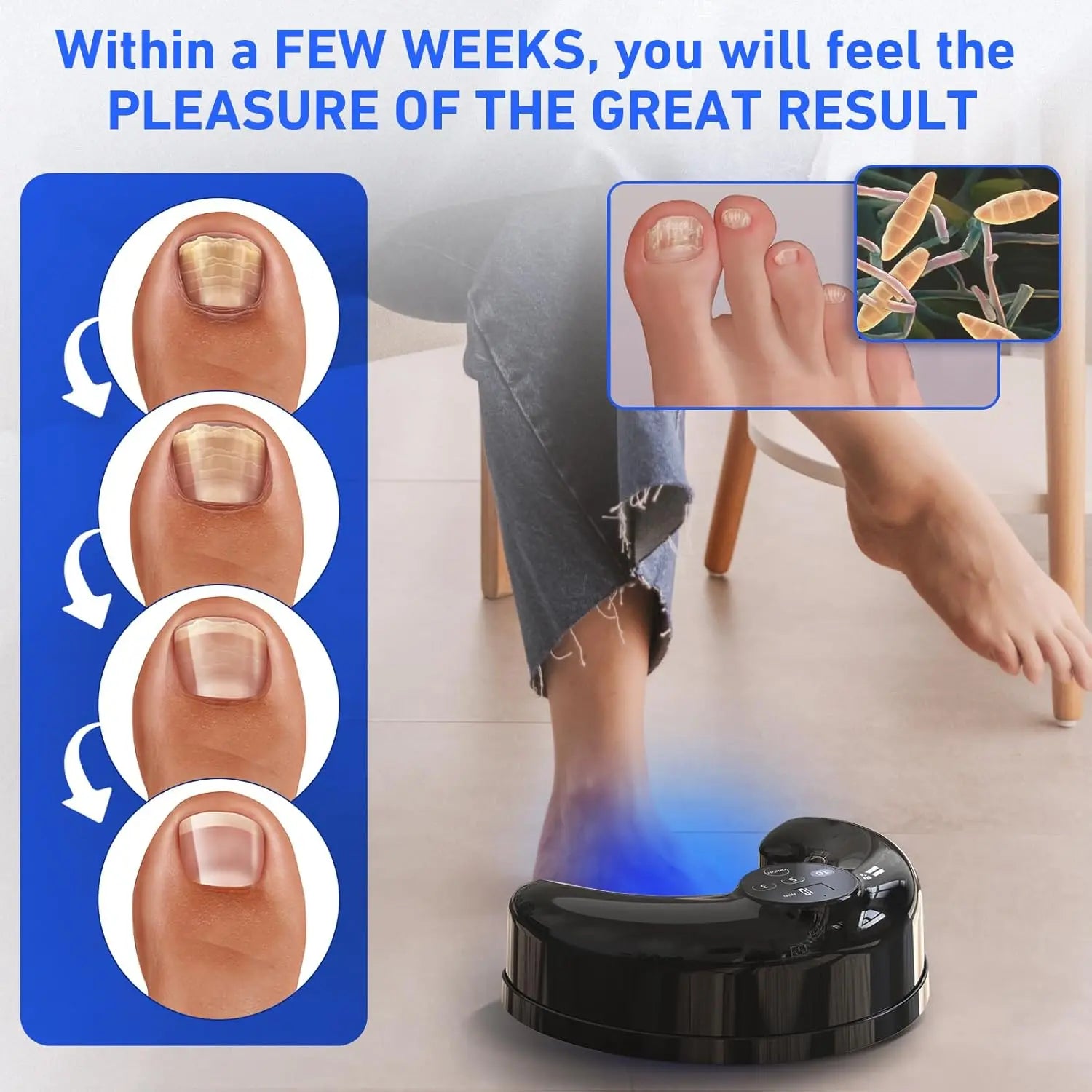 Wireless Nail Fungus Laser Device for Toenails Onychomycosis Infrared Light 470nm 910nm Blue Light Anti Fungal Laser Equipment