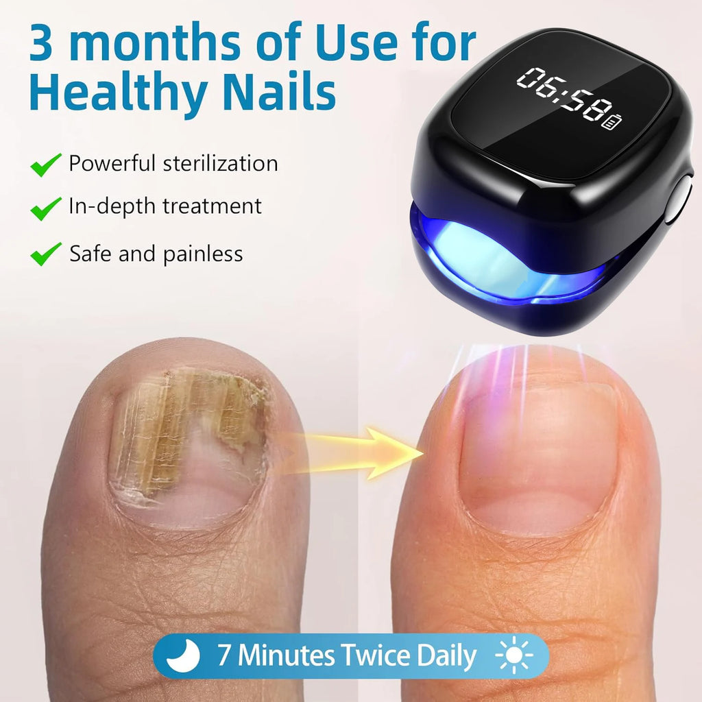 White/Black Fungal Nail Laser Device Repair Nails Fungus Onychomycosis Nail Fungus Cleaning Laser Device Foot Nail Care Tools