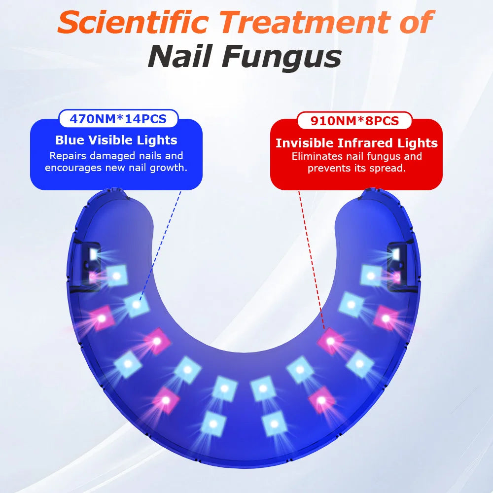 Wireless Nail Fungus Laser Device for Toenails Onychomycosis Infrared Light 470nm 910nm Blue Light Anti Fungal Laser Equipment