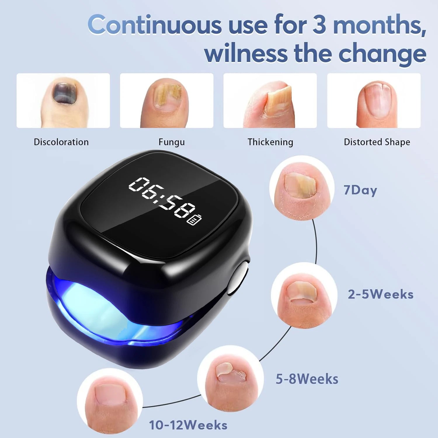 White/Black Fungal Nail Laser Device Repair Nails Fungus Onychomycosis Nail Fungus Cleaning Laser Device Foot Nail Care Tools