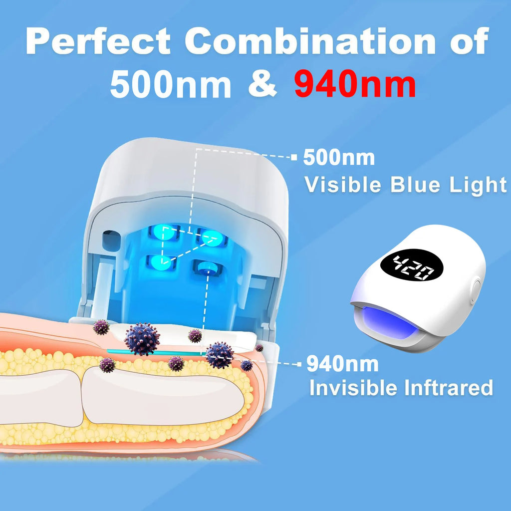 USB Charging Nail Fungus Treatment Device - 940nm Infrared & 500nm Blue Light LED Laser Onychomycosis Nail Care